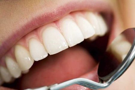 توصیه هایی برای بهداشت دهان و دندان در نوروز