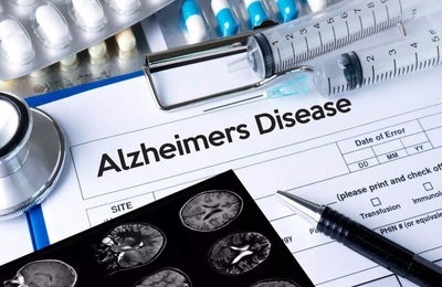 یک عامل مهم برای پیشگیری از آلزایمر را بشناسید