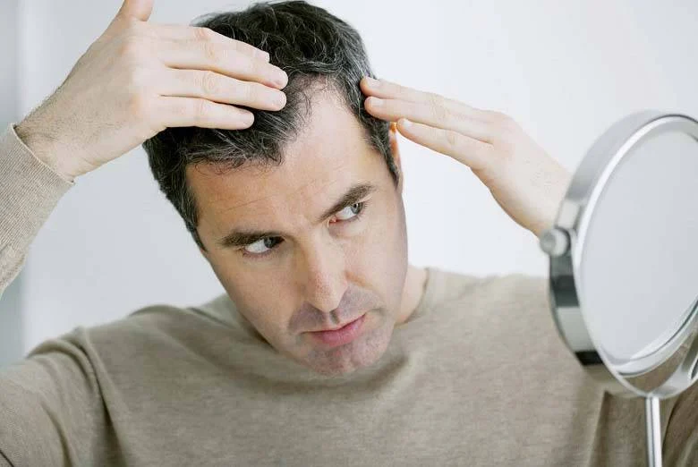 &nbsp;آیا ریزش مو می تواند به صورت ناگهانی اتفاق بیفتد؟
